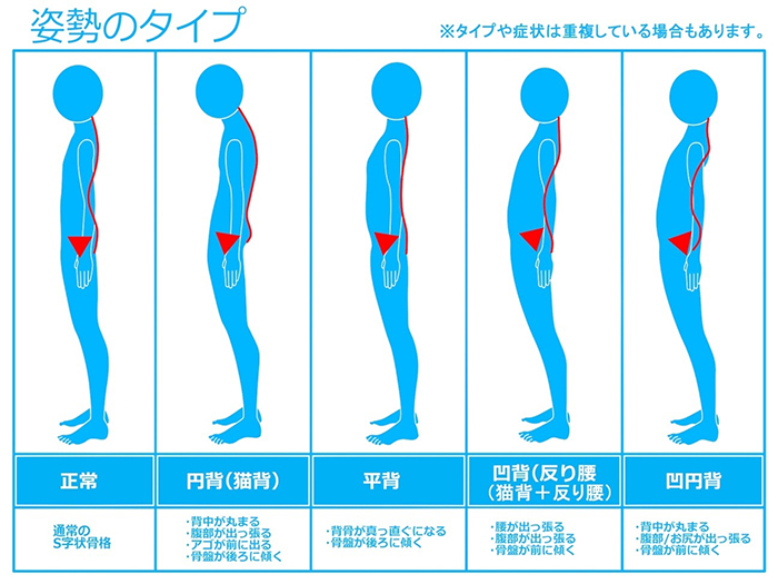 日常のちょっとした意識で改善 身体の歪みの原因と対処法1 伊勢崎市の取れない痛み 交通事故治療なら接骨院がく