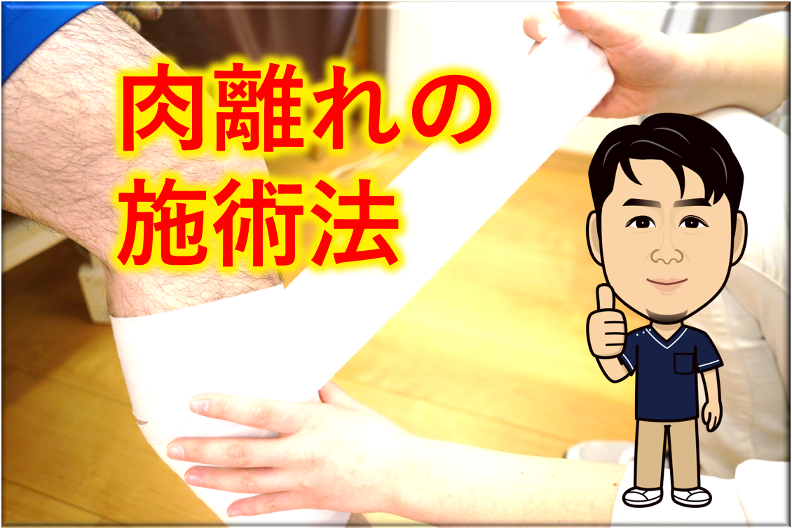 肉離れの施術法と改善の仕方 伊勢崎市の接骨院がく整骨院 針灸整体院グループ 平日夜２１時まで予約受付 女性スタッフも在籍