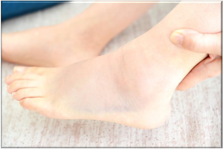 足首の捻挫の原因と改善方法